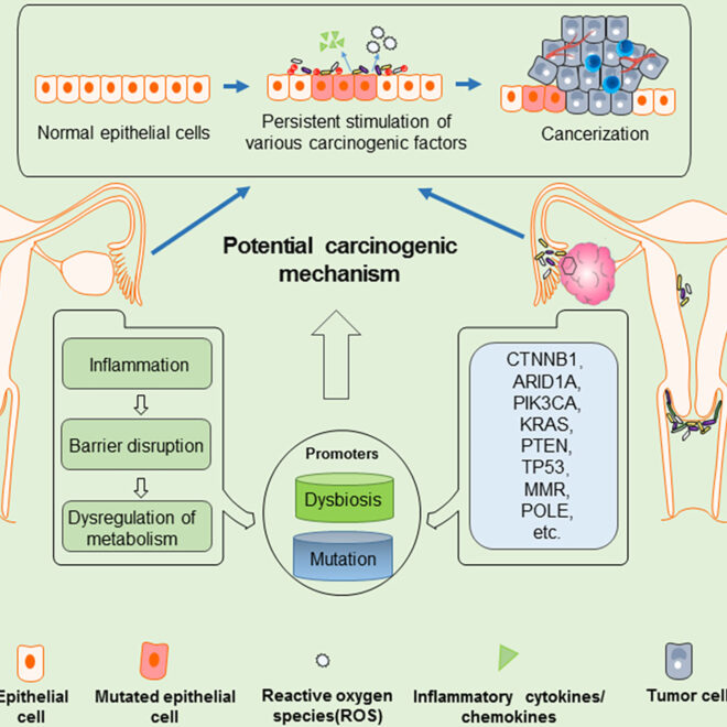 Endometrial Cancer: Causes, Symptoms, Diagnosis & Treatment