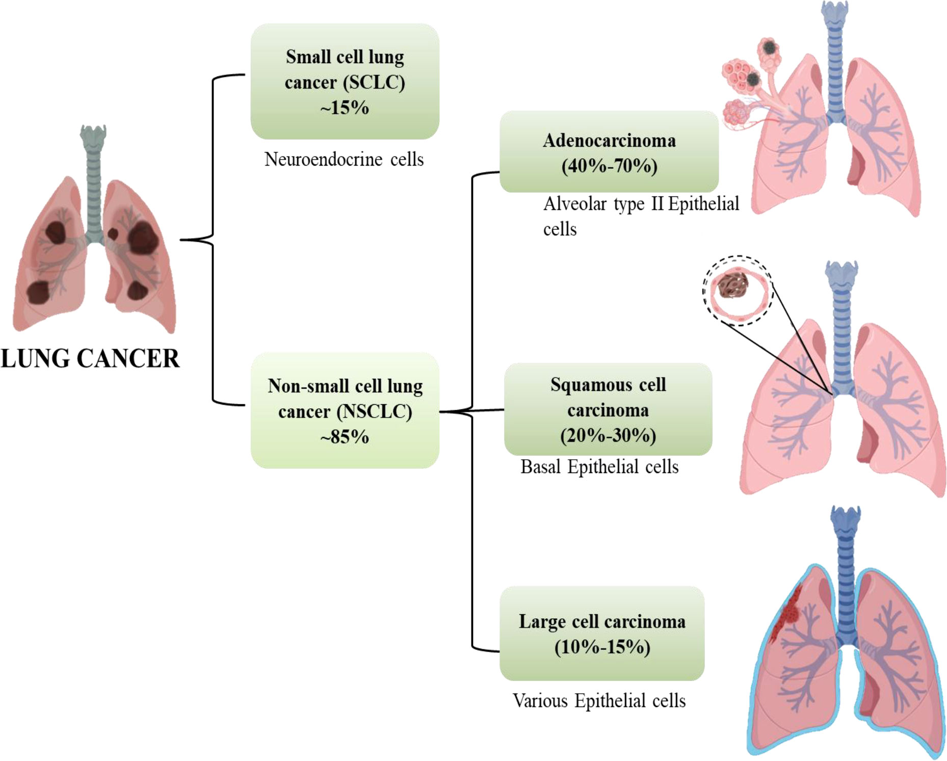 Small Cell Lung Cancer (SCLC): Overview, Symptoms, Diagnosis & Care