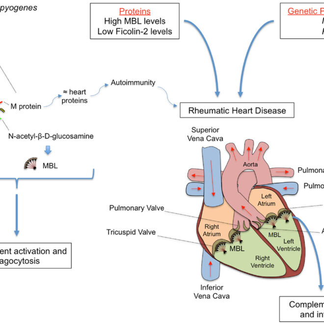 Rheumatic Heart Disease: Causes, Symptoms, and Care
