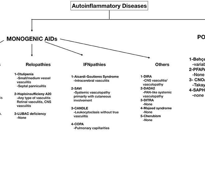 Vasculitis: Types, Symptoms, Causes, Diagnosis & Treatment