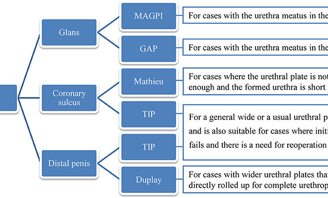 Hypospadias: Understanding the Condition, Its Causes, Diagnosis, and Treatment Options