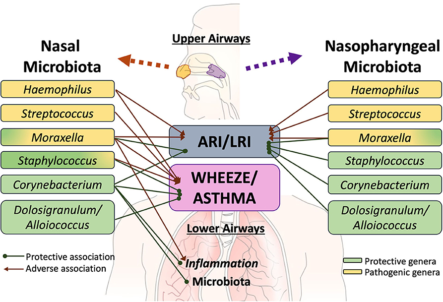 Upper Respiratory Tract Infections (URTIs): Causes, Symptoms, and Care