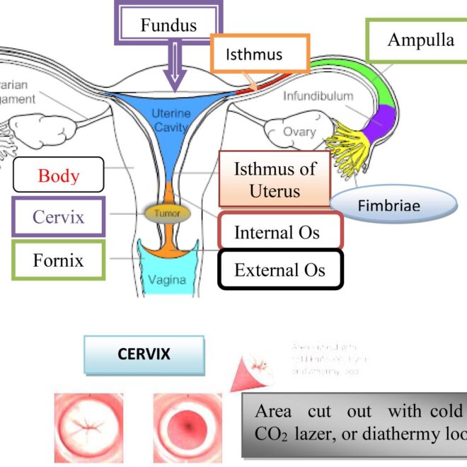 Cervical Cancer: Understanding Causes, Symptoms, and Treatments
