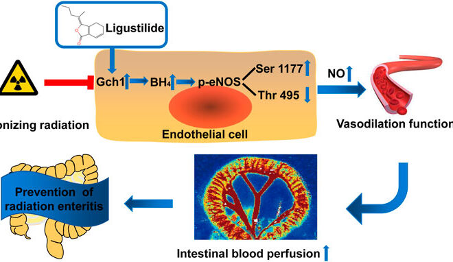 Radiation Enteritis: Causes, Symptoms, and Management