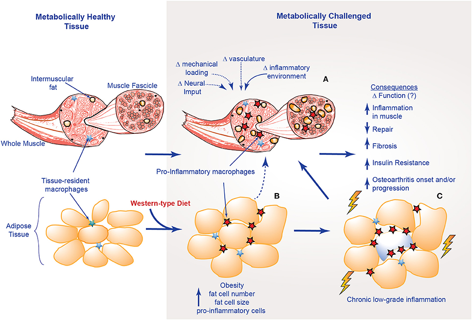 Inflammation of Muscles (Myositis): Causes, Symptoms, and Treatments