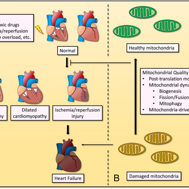 Heart Muscle Disease (Cardiomyopathy): Types, Causes, Symptoms & Care
