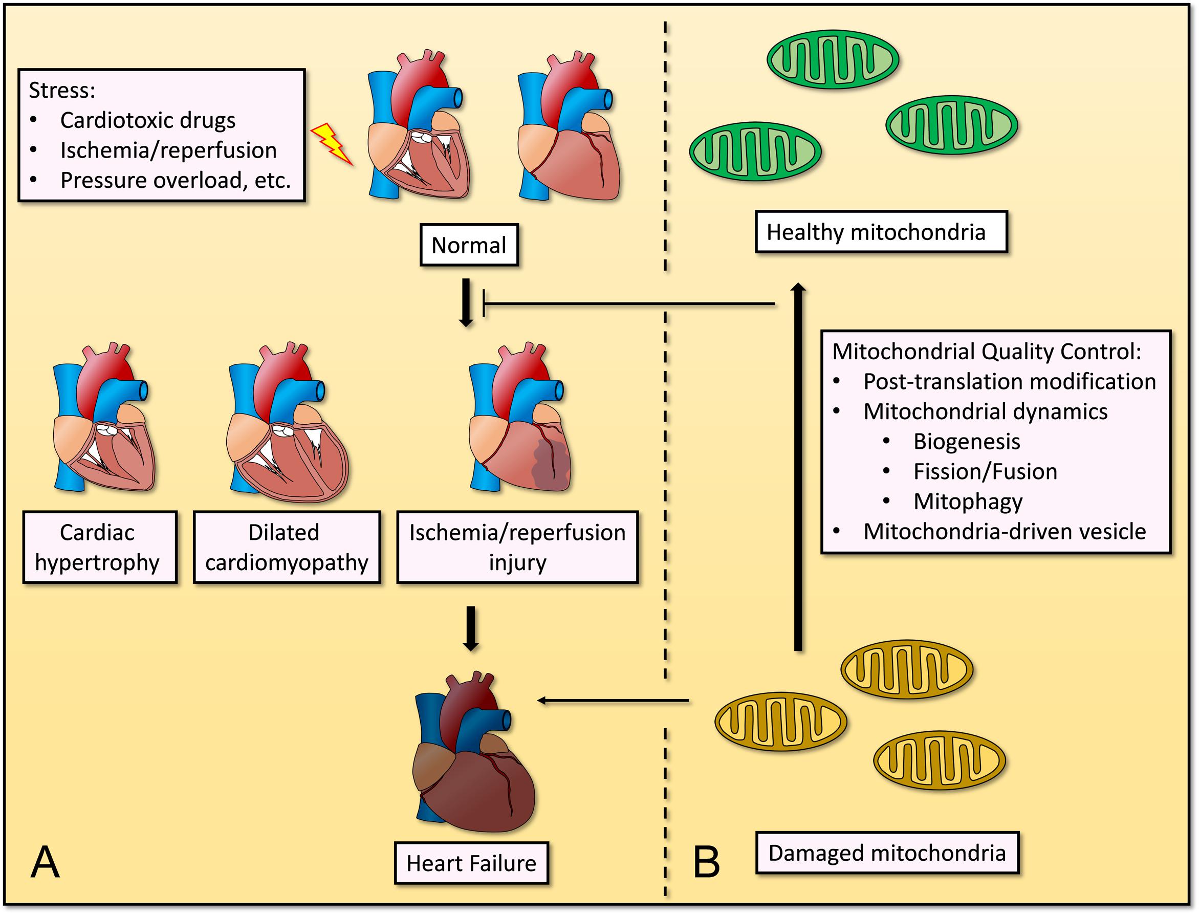 Ischemic Cardiomyopathy: Overview, Causes, Symptoms, and Treatments