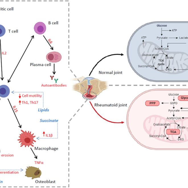 Juvenile Rheumatoid Arthritis (JRA): A Complete Guide