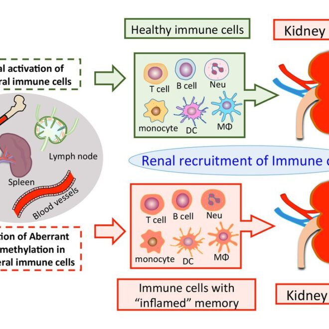 Kidney Inflammation (Nephritis): Causes, Symptoms, and Care