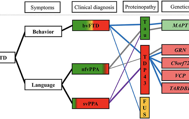 Frontotemporal Dementia: Overview, Symptoms, Causes & Progression