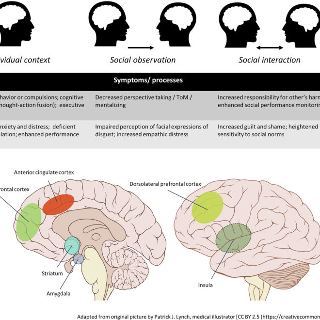 Obsessive Compulsive Disorder (OCD): A Complete Guide