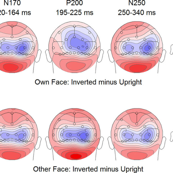 Body Dysmorphic Disorder (BDD): Symptoms, Causes, and Treatments