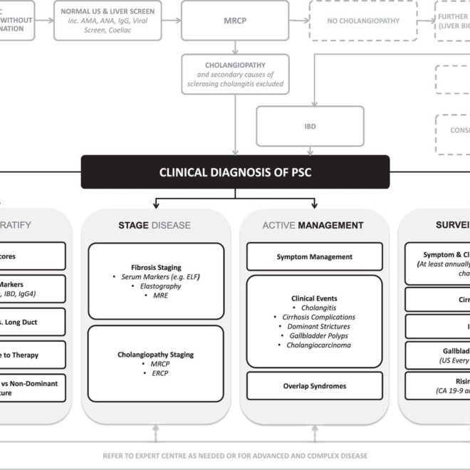 Primary Sclerosing Cholangitis: Overview, Symptoms, Diagnosis & Care
