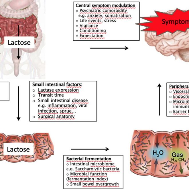 Lactose Intolerance: Causes, Symptoms, and Management