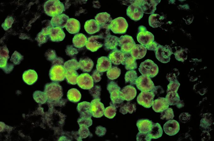 Brain-Eating Amoeba (Naegleria Fowleri): Overview, Symptoms, and Prevention