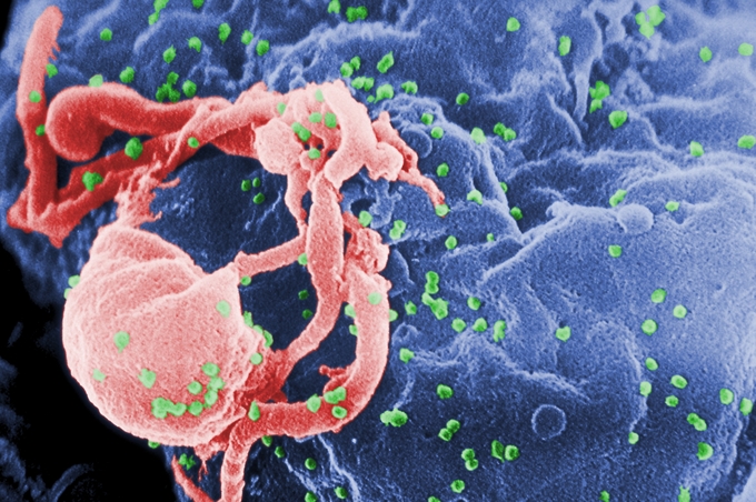 Human Immunodeficiency Virus (HIV) and Acquired Immunodeficiency Syndrome (AIDS): Overview, Causes, Symptoms, and Treatment