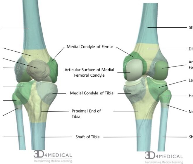 Meniscus Injury (Torn Cartilage in Knee): Overview, Symptoms, Diagnosis & Care