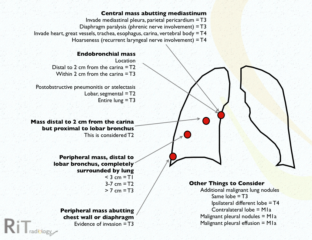 Lung Cancer: Types, Symptoms, Diagnosis, and Treatments