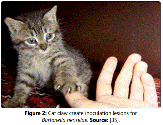 Cat Scratch Disease (Cat Scratch Fever): Overview, Causes, Symptoms & Care