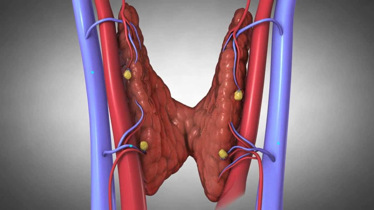 Hypoparathyroidism: A Complete Guide to Low Parathyroid Hormone Levels