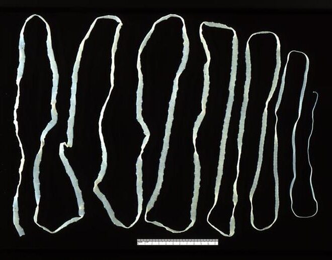 Tapeworm Infection (Intestinal Parasite): Causes, Symptoms, Diagnosis & Treatment