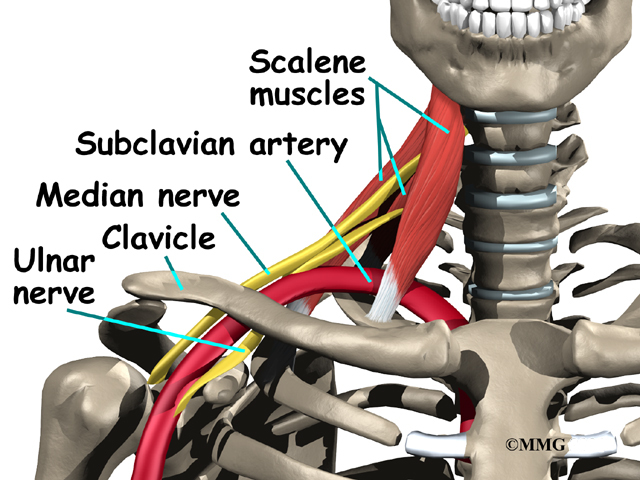 Thoracic Outlet Syndrome: Understanding the Condition, Its Causes, and Treatments