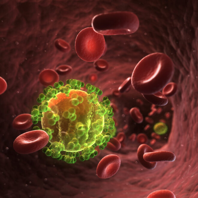 Human Immunodeficiency Virus (HIV) and Acquired Immunodeficiency Syndrome (AIDS): Overview, Causes, Symptoms, and Treatment