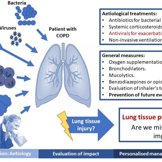 Chronic Obstructive Pulmonary Disease (COPD): Overview, Causes, Symptoms & Care