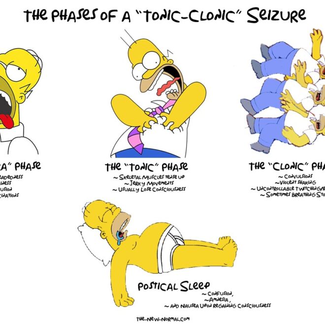 Grand Mal Seizure (Tonic-Clonic Seizure): Overview, Triggers, and Management