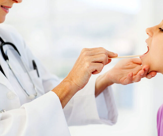 Tonsil Stones: Causes, Symptoms, and Removal Options