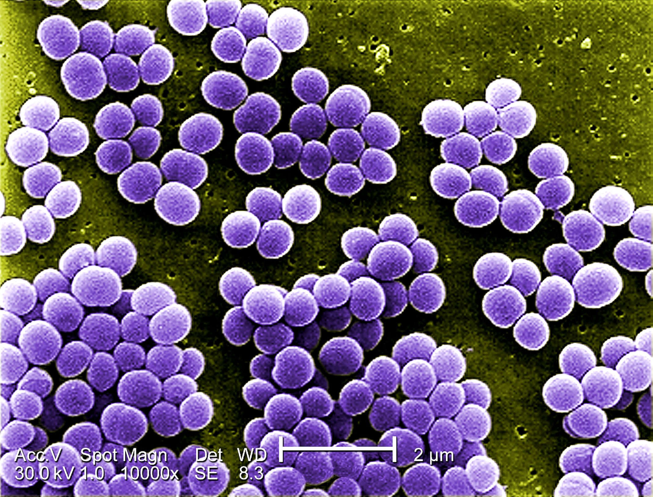 Staph Infections (Staphylococcus): Types, Causes, Symptoms & Treatments